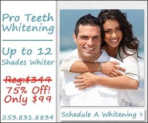 In office teeth whitening 99.00