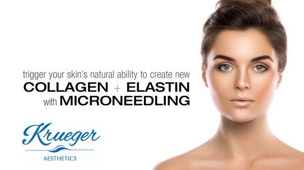 Microneedling