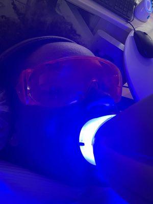 Zoom whitening