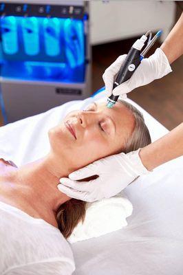 Hydrafacial