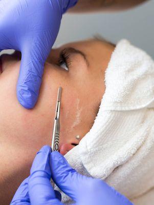 Dermaplaning