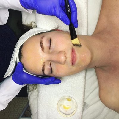 Rejuvenate Facial