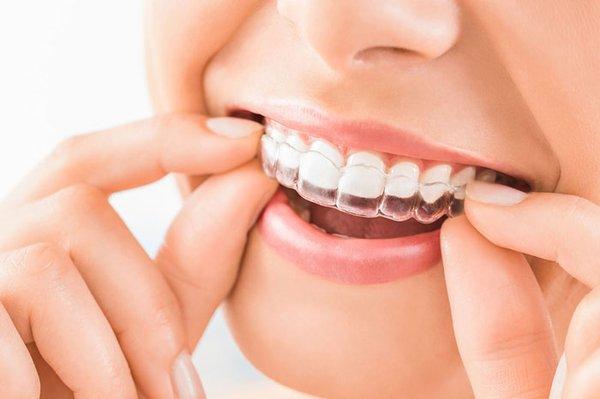 We offer Invisalign orthodontic treatment to straighten your teeth