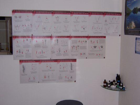 neuromuscular trigger point charts. This modality is a sure winner for pain relief!