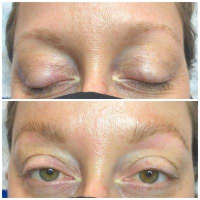 Eyebrow shaping and tinting