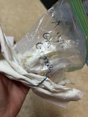 How Image Orthodontics packaged my mold and retainer