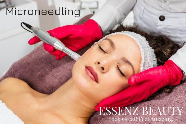 Microneedling