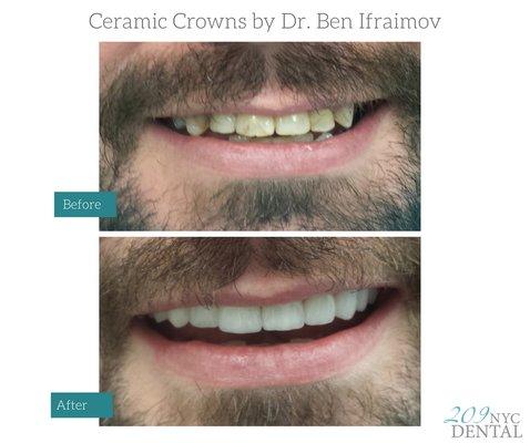 Cosmetic Dental Treatment by Dr. Ben Ifraimov