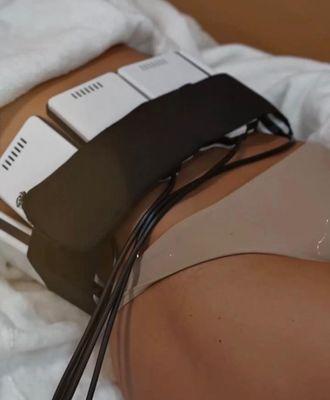 EMS Sculpting uses electrical muscle stimulation to tone muscles and enhance body contour. It helps build muscle and reduce fat in targeted.