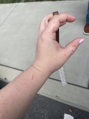 Cuts on wrist and fingers from not de-thorning the roses in her wedding bouquet.