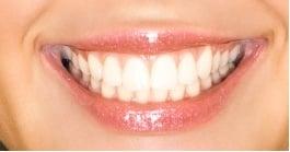 Keeping our teeth their whitest is a lot harder than it sounds. With all the coffee, wine, smoking and other foods