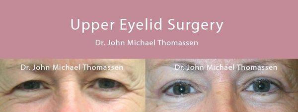 Fort Lauderdale Plastic Surgery by Dr. John Michael Thomassen - Board Certified Plastic Surgeon...