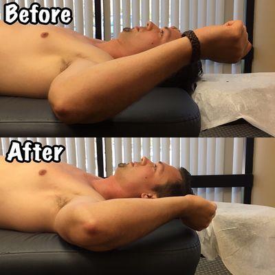 Before and after external rotation.