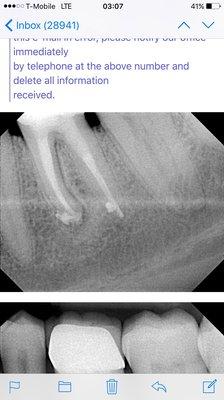 This is why I hate dentists