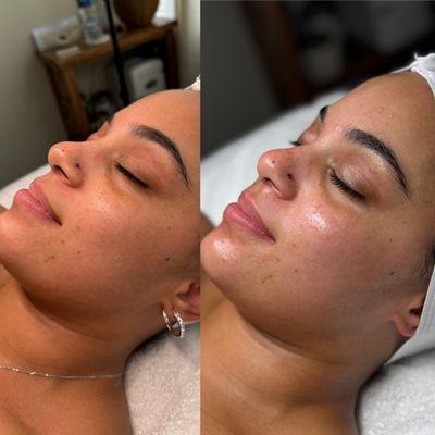 Customized facial