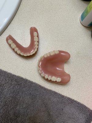 They are my dentures that they made from me. They are so big and these ones make me have a monkey mouth