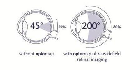 Come see us for an Optomap Digital Retinal scan today!