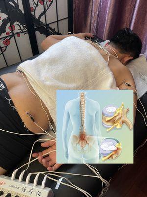 Eastern Natural Therapy Center with Acupuncture and Massage