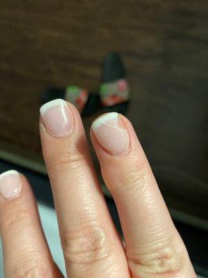 Broken nail and extremely crooked nail. Also super thick so it's immediately noticeable when your nail grows 1mm.