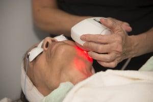 Derma Laser