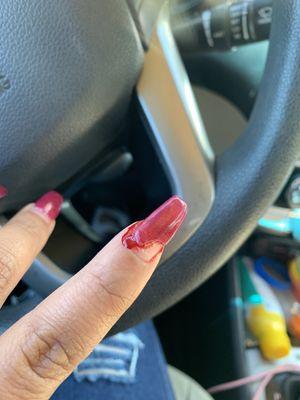 My natural nail is breaking off completely