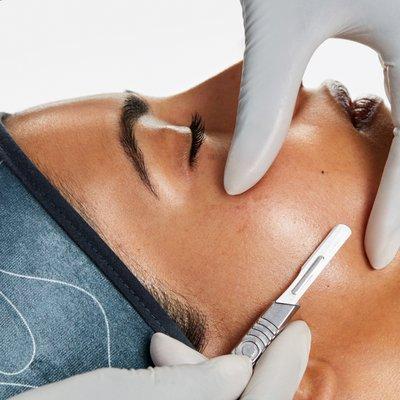 Dermaplaning