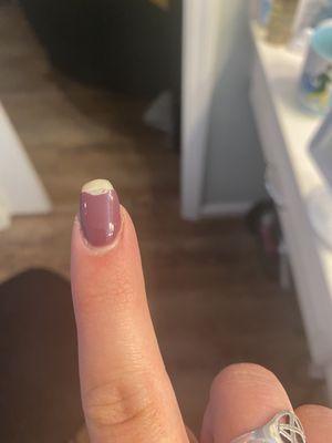 Broken nail on index finger