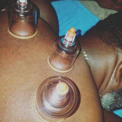 Cupping massage: using special suction cups to help alleviate any muscle pain. Very popular for those who prefer deep tissue massage.