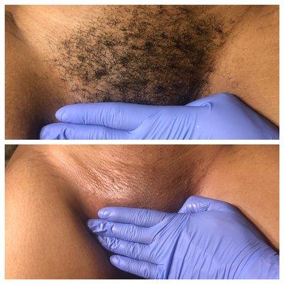 Brazilian Wax