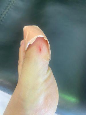 My friend's left foot with the cut.