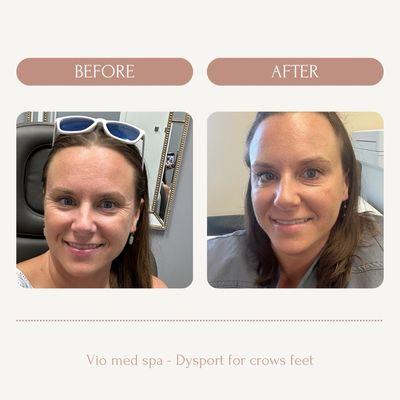 Wow!  Bye bye crows feet!