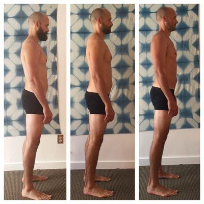 Postural transformation over a 10-session Rolfing series. Photo shows week 1, 5, and 10