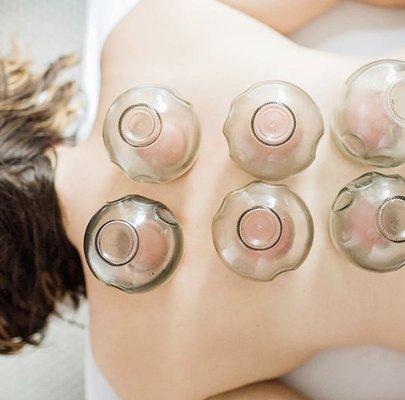 Cupping therapy in houston, Texas