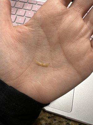 Fingernail in lo mein