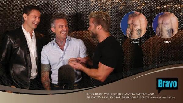 Dr. Cruise with Gynecomastia patient and star of  Bravo's Newlywed star, Brandon Liberati