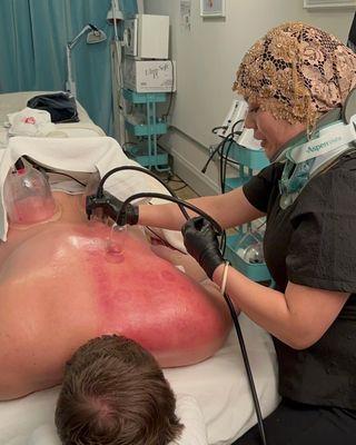 Patient getting his back and shoulder pain treated with cupping and Gua Sha treatment.