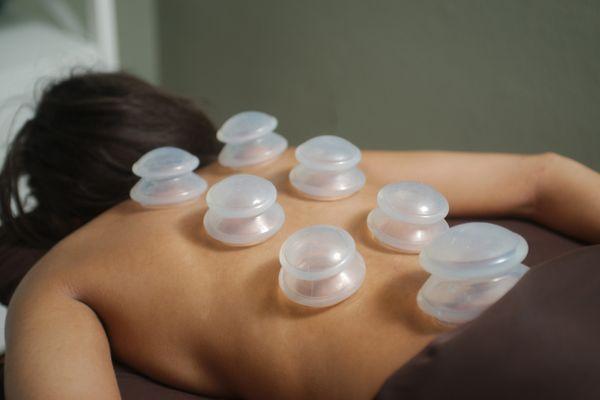 Cupping available with select massage therapist