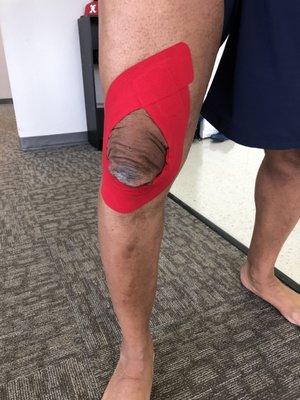 Kinesio taping a clients knee to improve his stability before an athletic event