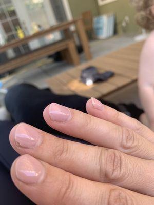 Chipped nails