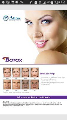 Botox can help