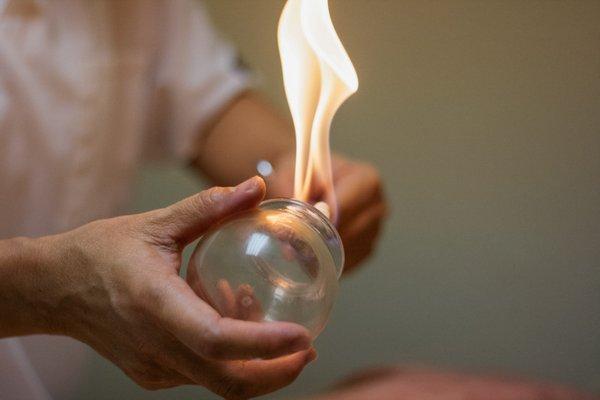 Pauline performing 'fire cupping.' The flame creates a suction and warms the cup, which is then placed along the back to release tension.