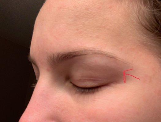 This is after. The red arrow points to the white line of where my bottom brow line was before