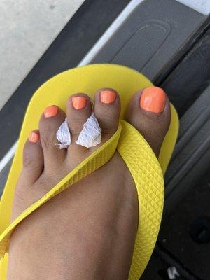 Ugly toe nails