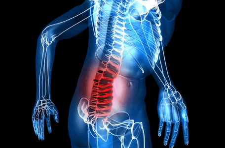 Low back pain is a commonly treated condition