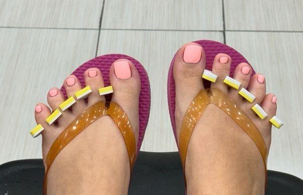 Pedicure with Ingrown removal