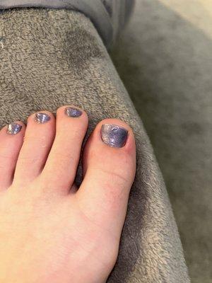 Day after pedicure- ingrown toenail