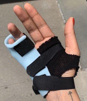 Splint