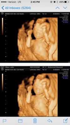 The baby's face and arms at only 16 weeks and 3 days