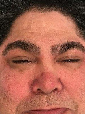 After Photo - Brow Client