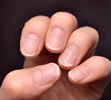 Nails so damaged after getting gel mani then getting it removed here